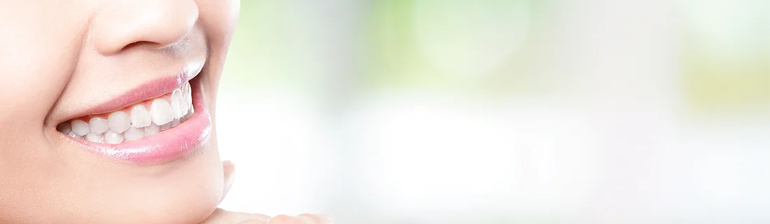 Inman Aligner in Cottonwood Heights UT Inman Aligner in Cottonwood Heights UT